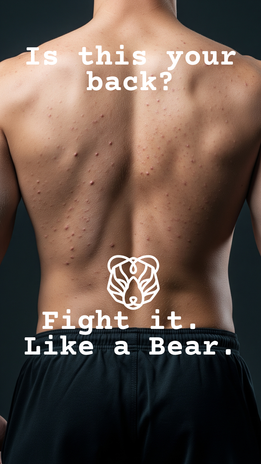 Body Wash – Anti-Pickel Duschbehandlung